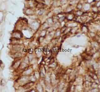 Anti-CTNNB1 antibody - Click Image to Close